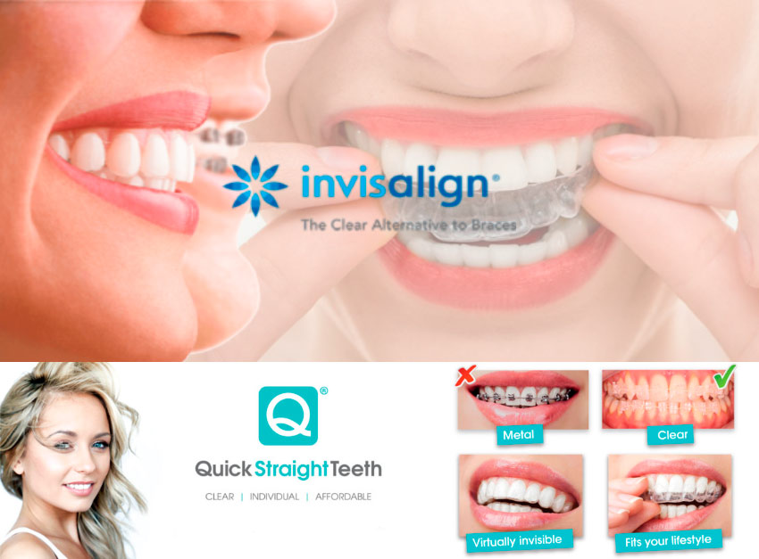 Grat Junction Dental Invislaign